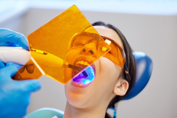 When Is A Dental Filling Needed?